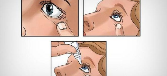 Капли в глаза от аллергии названия