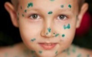 Как выглядит аллергия на коже у ребенка
