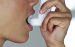 Бронхиальная астма кашлевая форма симптомы
