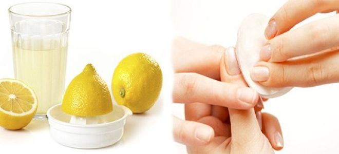 Почему после шеллака чешутся пальцы