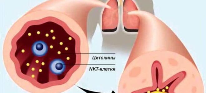 Ингалятор от астмы название