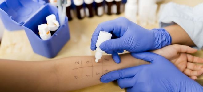 Как понять что у меня аллергия