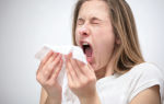 Аллергия виды аллергических реакций