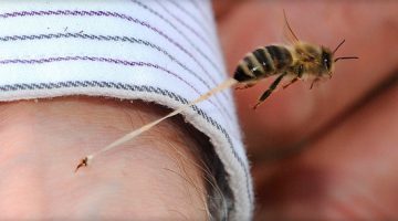 Аллергия на пчелиный яд