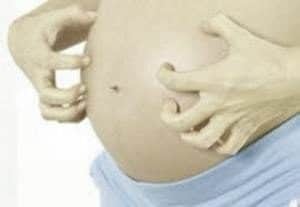 Крапивница при беременности влияние на плод