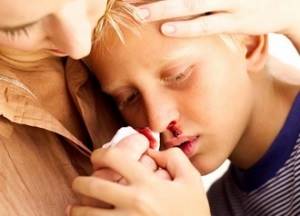 Вазомоторный ринит у детей симптомы и лечение