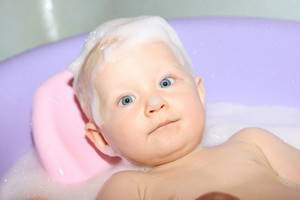 Можно ли мыть ребенка при крапивнице