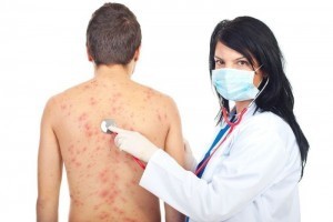 Мази при аллергии на коже у взрослых