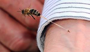 Аллергия на укусы насекомых лечение