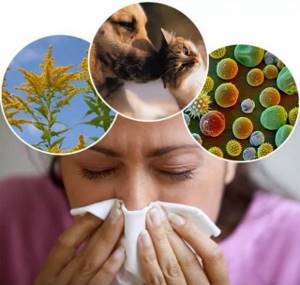 Как облегчить аллергию в домашних условиях