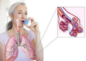 Дыхательная гимнастика при бронхиальной астме