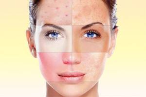 Аллергия на крем для лица