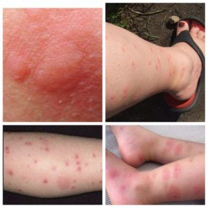 Аллергия на шерсть животных