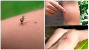 Как выглядит укус комара