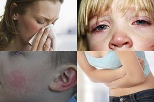 Аллергия на сливы