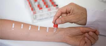 Общий анализ крови при аллергии