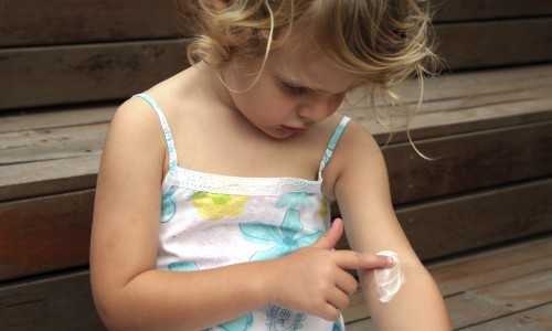 Мазь от дерматита для детей до года