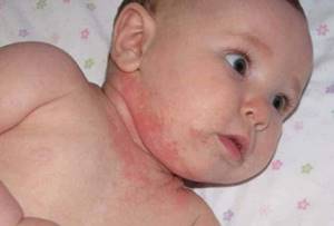 Детский крем от дерматита