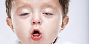 Аллергический кашель у ребенка что делать