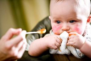 Аллергия у ребенка на щечках