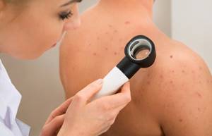 Проявление аллергии на коже у взрослых
