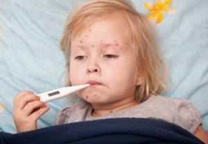 Температура на аллергию у детей