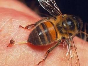 Аллергия на пчелиный яд