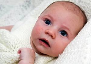 Бепантен при аллергии у новорожденных