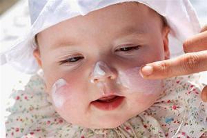 Как выглядит аллергия у младенца