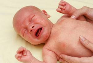 Аллергия на яичный белок у ребенка
