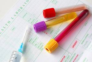 Показатель аллергии в анализе крови ребенка