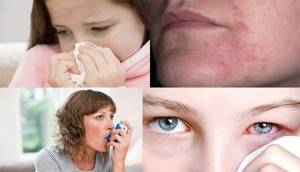 Что такое перекрестная аллергия