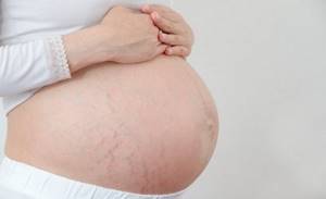 Атопический дерматит при беременности лечение