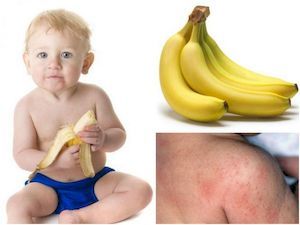 Банан аллерген