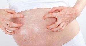 Мазь от дерматита при беременности