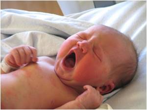 Аллергия у новорожденного чем лечить