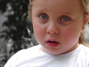 Аллергический ринит у ребенка симптомы и лечение