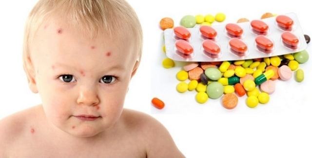 Детские препараты от аллергии