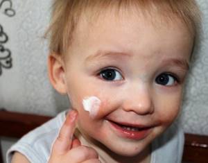 Аллергия на руках у ребенка